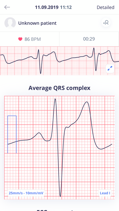 Cardiolyse Screenshot