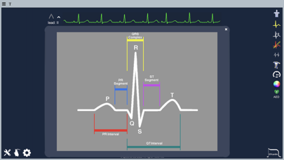 Epicardio Heart Simulatorのおすすめ画像4