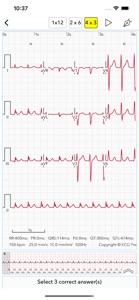 ECG Test Pro for Doctors screenshot #10 for iPhone
