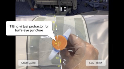 AR Needle Guide Screenshot