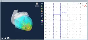 Epicardio Heart Simulator screenshot #4 for iPhone