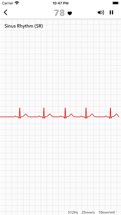 ECG+ | Analyzer for QTc & HRV screenshot-9