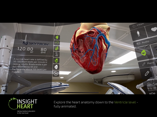 Captura de tela do INSIGHT HEART