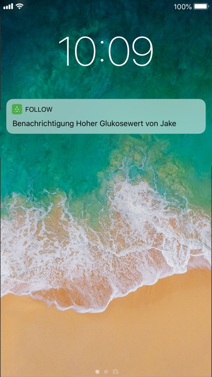 Dexcom Follow mg/dL DXCM1