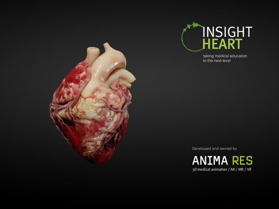 INSIGHT HEART iPad app afbeelding 10