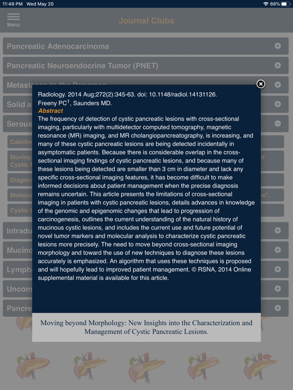 CTisus Pancreas Compendiumのおすすめ画像4