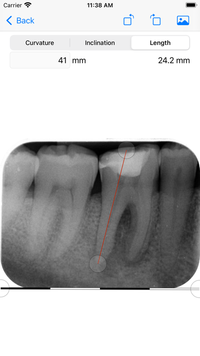 EndoPrep Screenshot