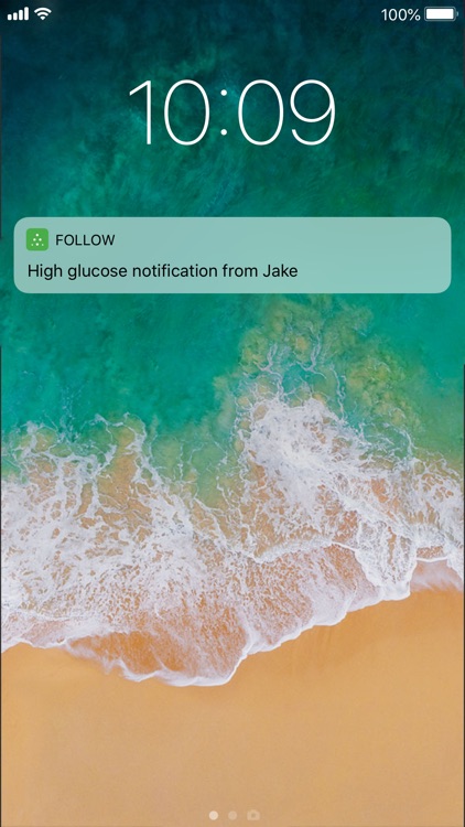 Dexcom Follow mmol/L DXCM15 screenshot-4