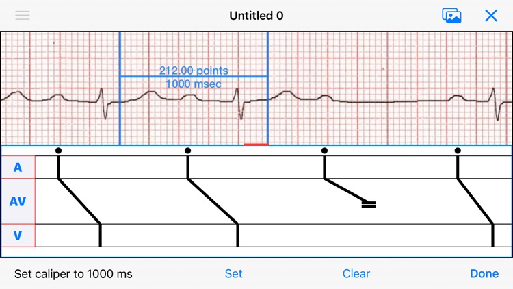 EP Diagram