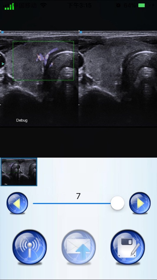 #3. SIUI PIE-3 (iOS) 来自: Shantou Institute of Ultrasonic Inst. Co., Ltd.