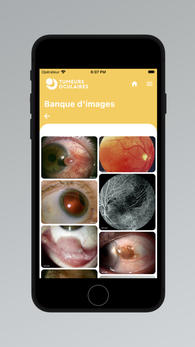 Tumeurs Oculaires Screenshot