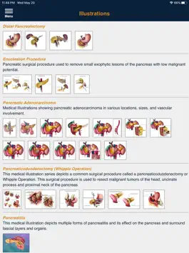 Game screenshot CTisus Pancreas Compendium apk