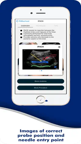 Game screenshot PNBschool Anesthesia Blocks hack