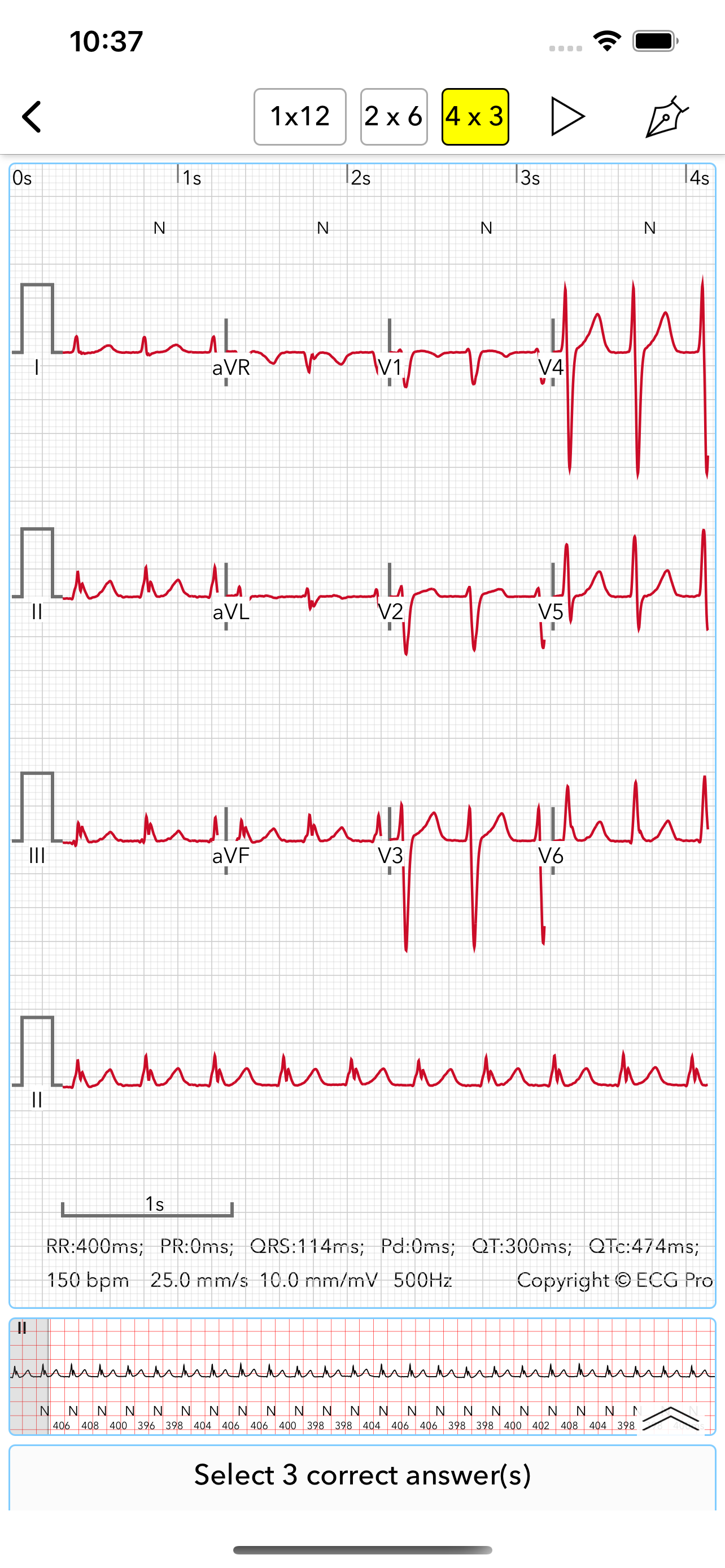 ECG Test for Doctors