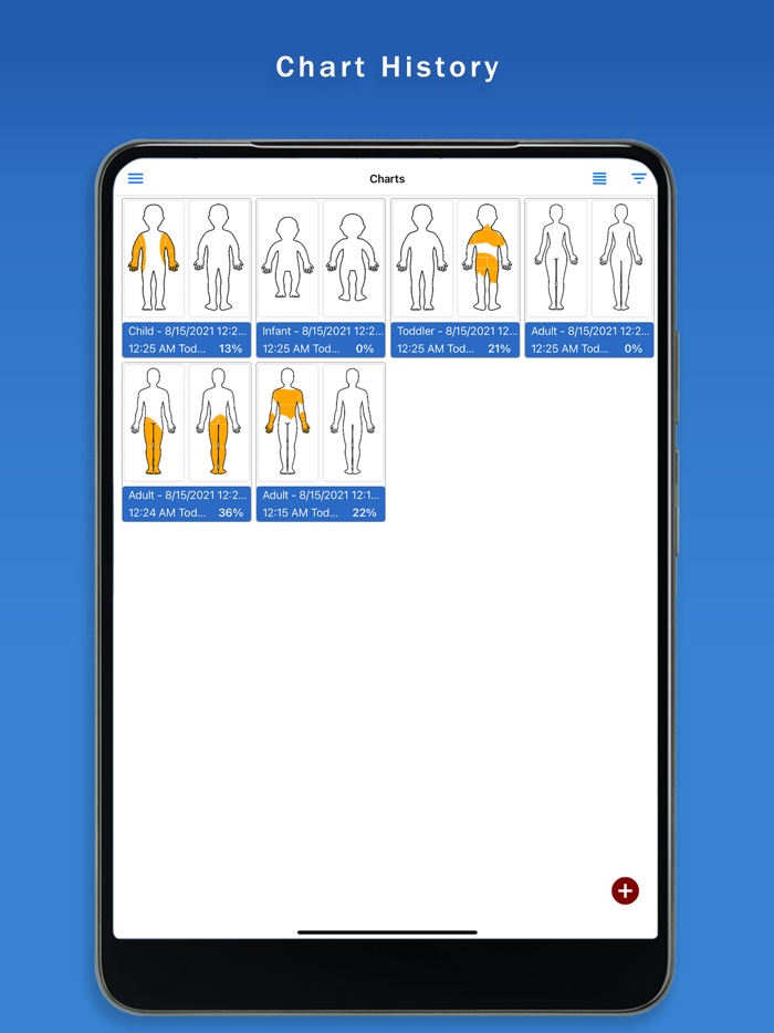 Surface Burn Calculator