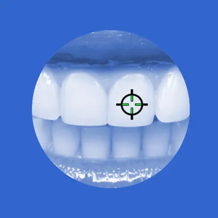 Intact-tooth Cheats