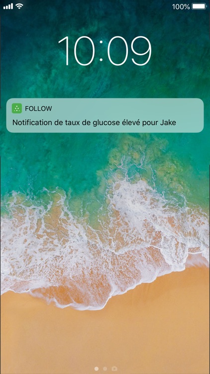 Dexcom Follow mg/dL DXCM2 screenshot-4
