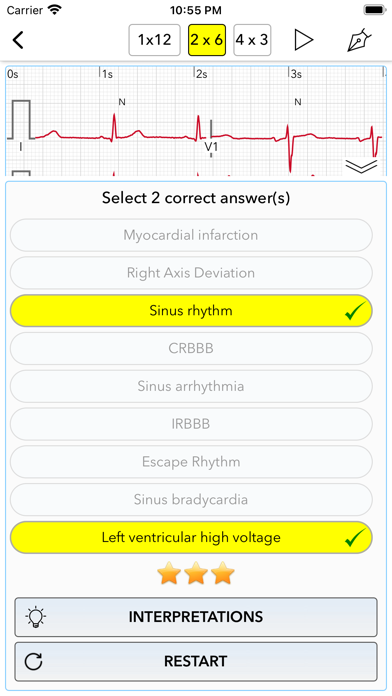 ECG Test Pro for Doctors Screenshot