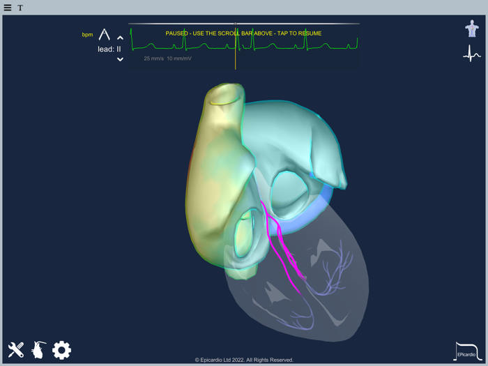 Epicardio Heart Simulator