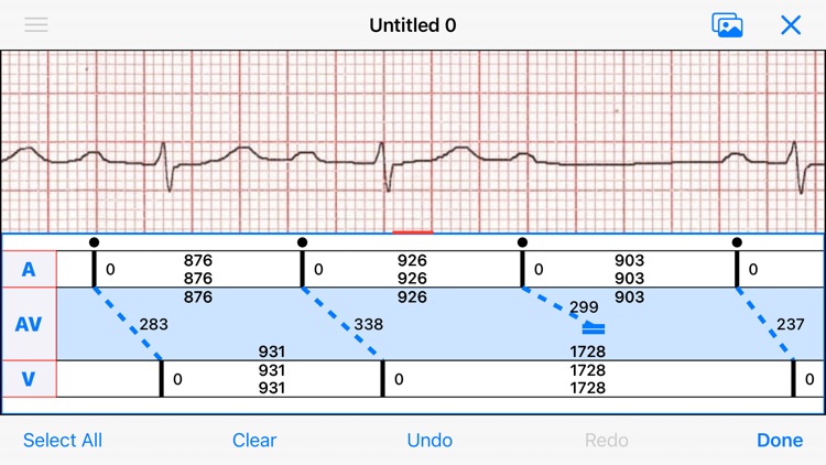 EP Diagram screenshot-4