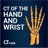 CTisus: CT of the Hand & Wrist - iPadアプリ