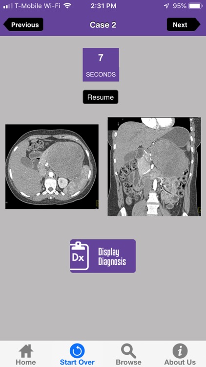CTisus Challenge: The Pancreas