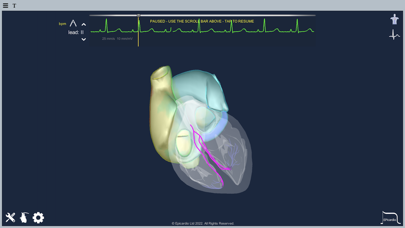 Epicardio Heart Simulatorのおすすめ画像6