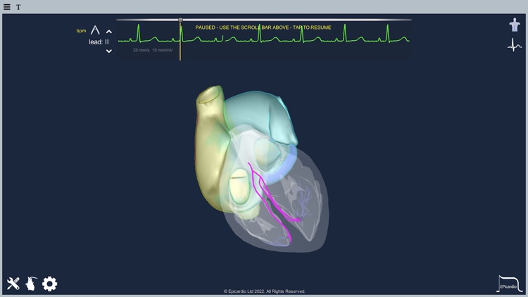 Epicardio Heart Simulator screenshot-5