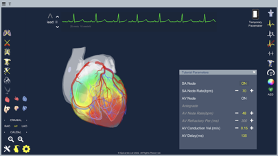 Epicardio Heart Simulatorのおすすめ画像5