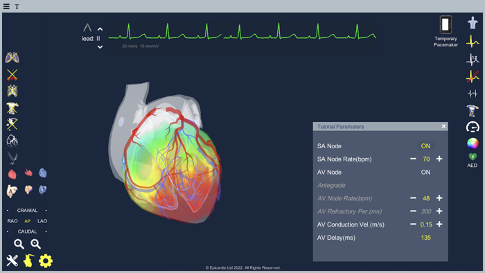 Epicardio Heart Simulator