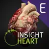 INSIGHT HEART Enterprise negative reviews, comments