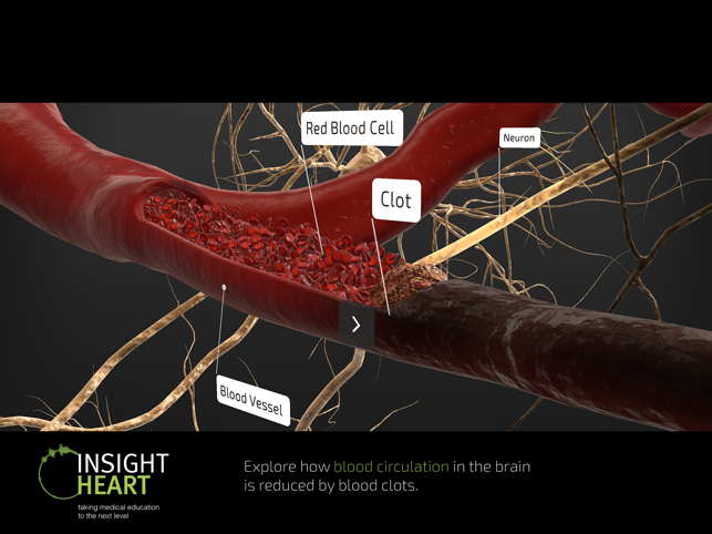 Pamja e ekranit ‎INSIGHT HEART