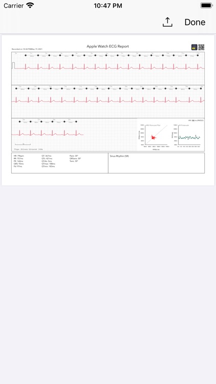 ECG+ | Analyzer for QTc & HRV screenshot-8