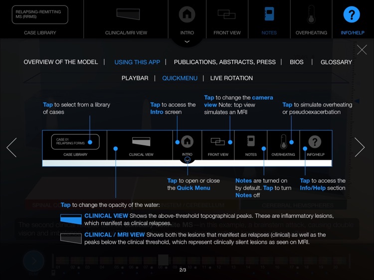 MS Topography screenshot-3