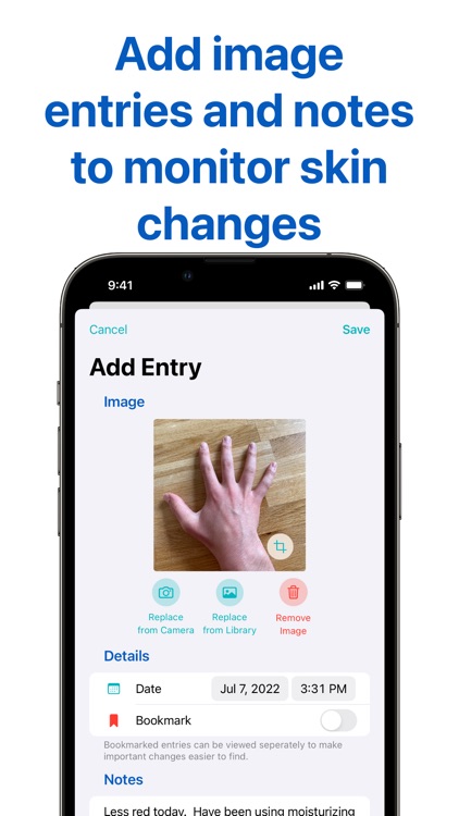 Derm Diary: Skin Tracker