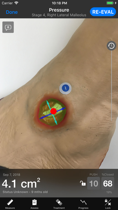 Swift Skin and Wound Training screenshot 2