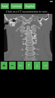 ct cervical spine iphone screenshot 3