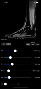 MRIcontrast screenshot #2 for iPhone