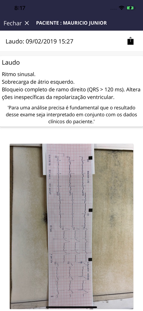 ECG com Laudo - Medical App | MWM