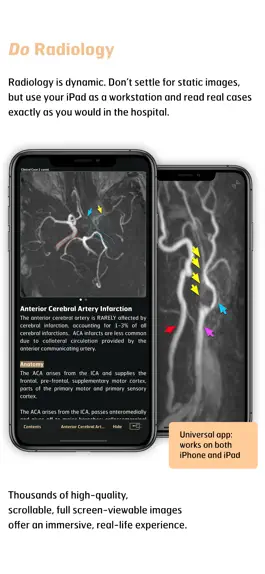 Game screenshot Radiology - Imaging in Stroke hack