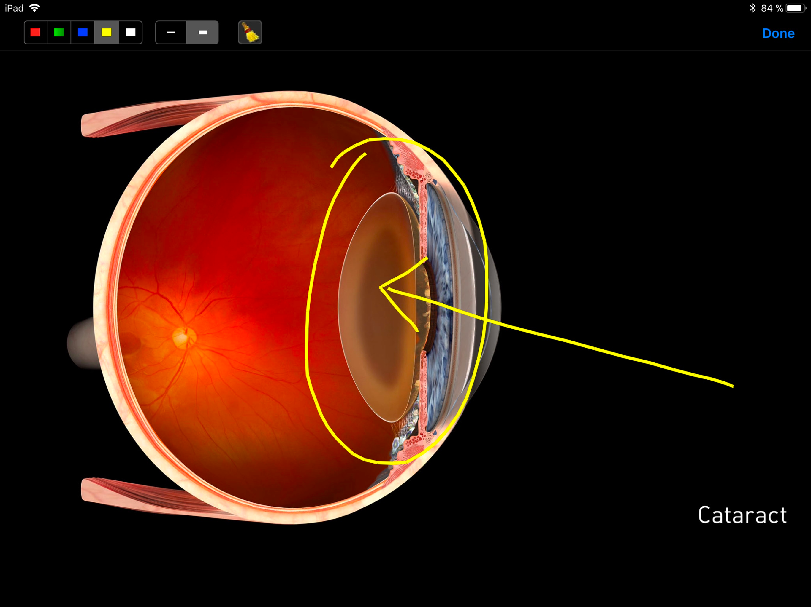 Sight Selector Subscription