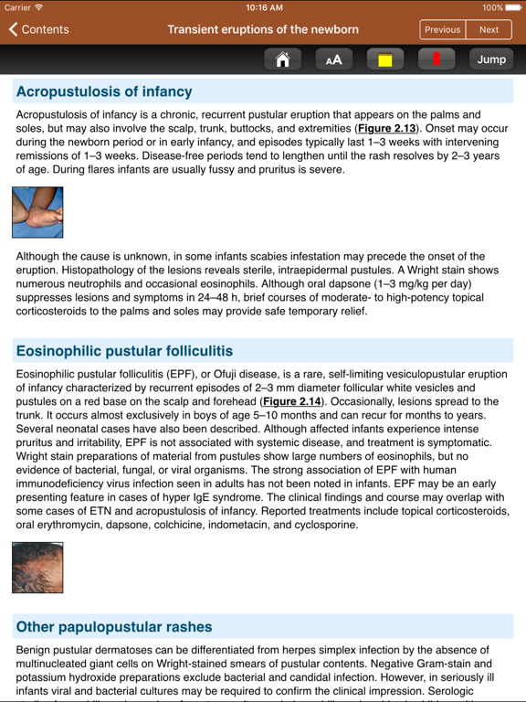 Screenshot #6 pour Cohen Pediatric Dermatology 4E