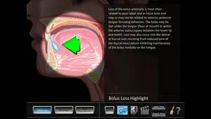 Oral Disorders screenshot 1
