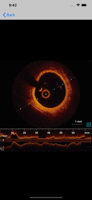 Texto de Cardiología SIAC RA(圖1)-速報App