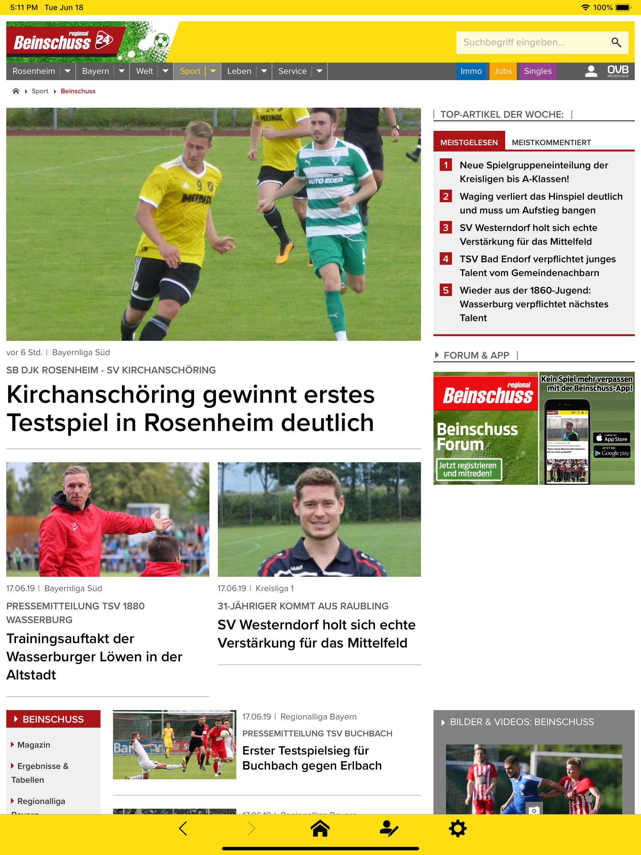 Beinschuss