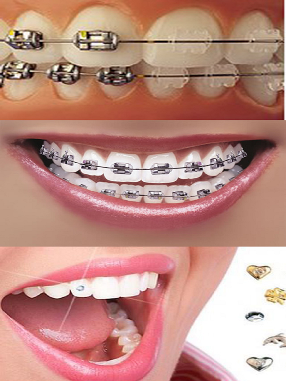 Screenshot #6 pour Orthodontic