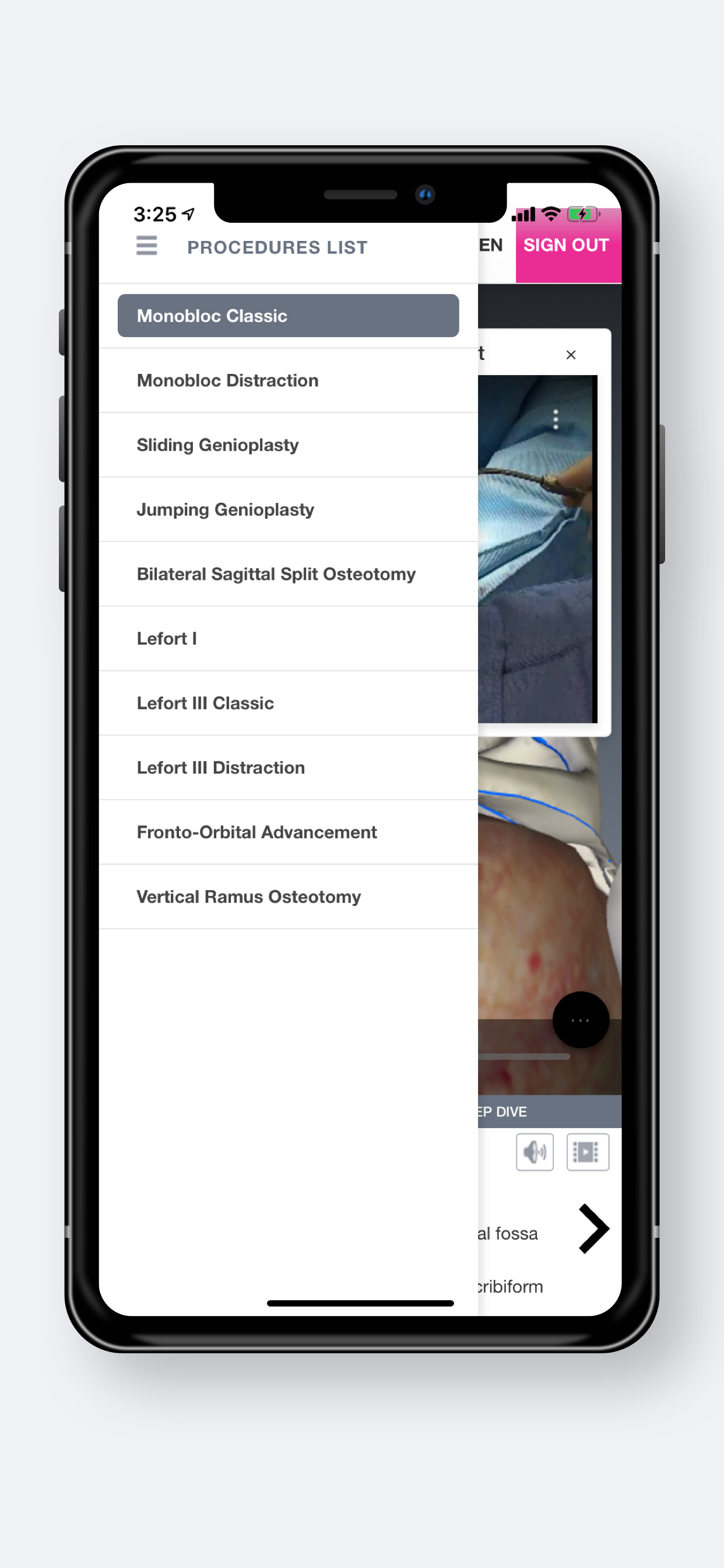 CIVA Pro screenshot 3