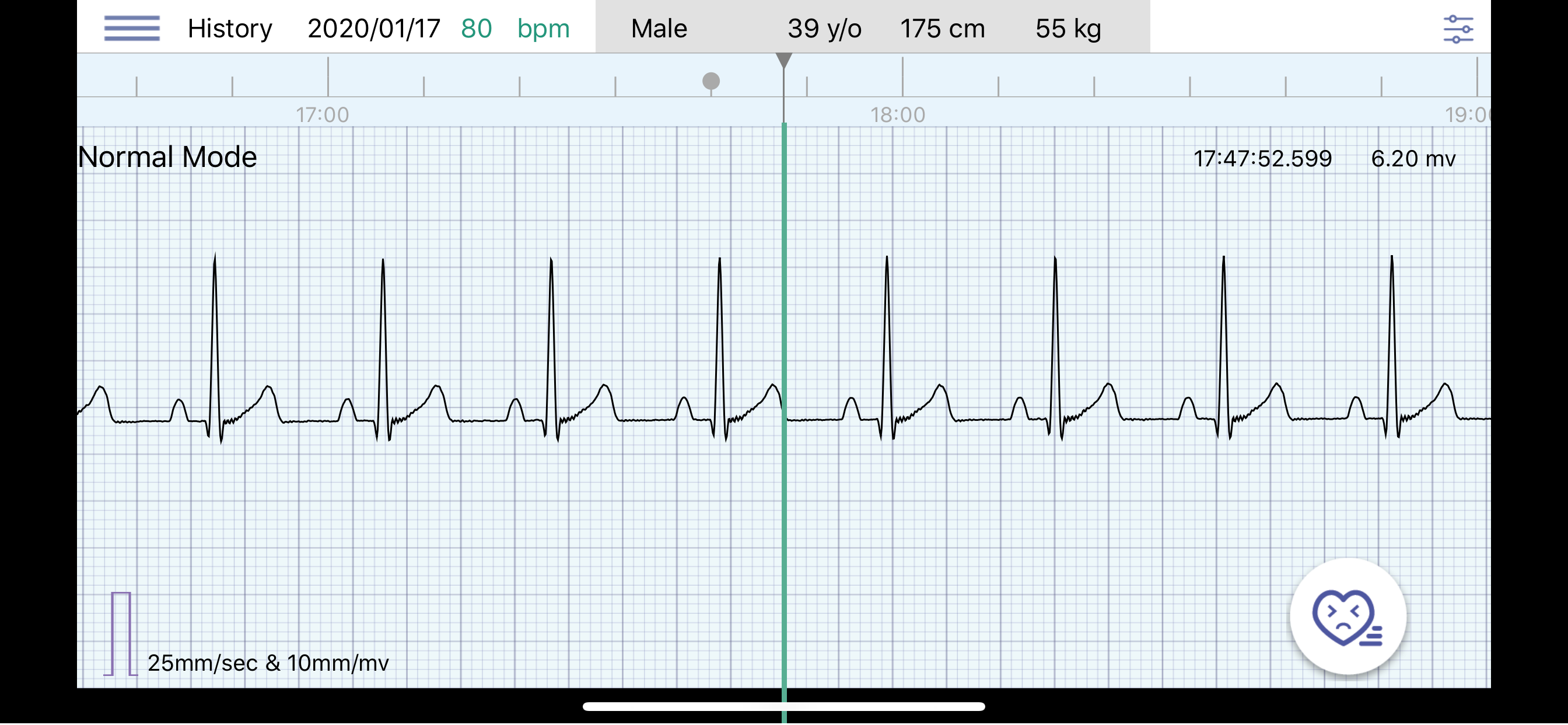 Q-ecg screenshot 3