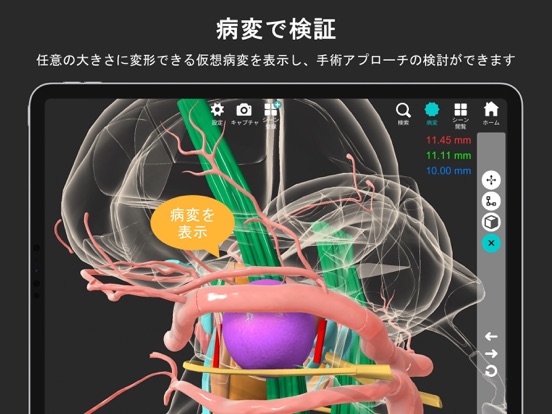 脳観 iPad screenshot 3 - Medical app