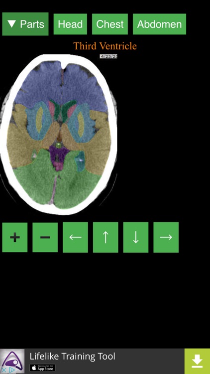 Anatomy on Radiology CT screenshot-4